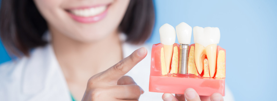 Zahnkrone auf Zahnimplantat